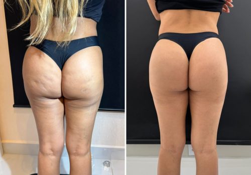 Imagem do WhatsApp de 2025-02-20 à(s) 08.40.44_d0770ffc