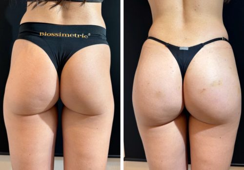 WhatsApp Image 2024-08-14 at 22.26.45